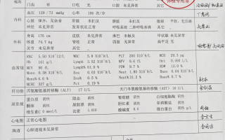 雅安找人代替抽血苏州工业园区入职体检